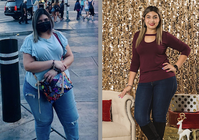 Mayra Reyes, before and after her weight-loss surgery, Texoma Medical Center, Denison, Texas